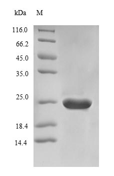 Recombinant Saccharomyces cerevisiae Nicotinamidase(PNC1)