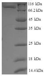 Recombinant Saccharomyces cerevisiae Translation initiation factor IF-2, mitochondrial(IFM1)