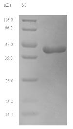 Recombinant Saccharum officinarum Sucrose synthase(SUS1),partial