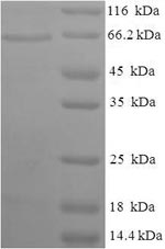 Recombinant Salmonella heidelberg D-serine dehydratase(dsdA)