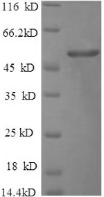 Recombinant Salmonella typhimurium Outer membrane porin protein OmpD(ompD)