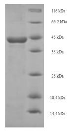 Recombinant Schistosoma mansoni Major egg antigen
