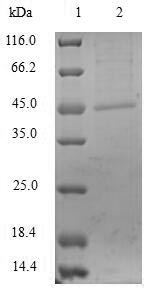 Recombinant Serratia marcescens Metallo-beta-lactamase type 2