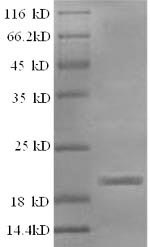 Recombinant Sheep Interleukin-1 beta(IL1B)