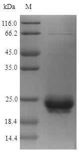 Recombinant Staphylococcus aureus 30 kDa neutral phosphatase,partial