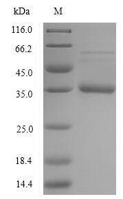 Recombinant Staphylococcus aureus Acyl carrier protein(acpP)