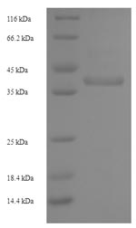 Recombinant Staphylococcus aureus Enterotoxin type G(entG)