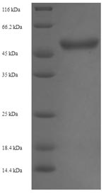 Recombinant Staphylococcus aureus Malonyl CoA-acyl carrier protein transacylase(fabD)