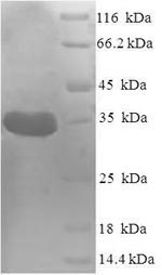 Recombinant Staphylococcus aureus Peptide deformylase(def)