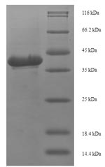 Recombinant Staphylococcus aureus Toxic shock syndrome toxin-1(tst)