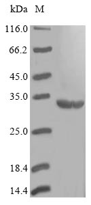 Recombinant Staphylococcus haemolyticus Dihydropteroate synthase(folP)