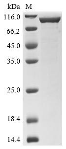 Recombinant Streptococcus pneumoniae serotype 4 Pneumolysin(ply),Biotinylated