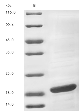 Recombinant Streptococcus pyogenes serotype M28 Holo-[acyl-carrier-protein] synthase(acpS)