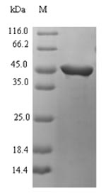 Recombinant Streptococcus pyogenes serotype M28 Streptopain(speB)