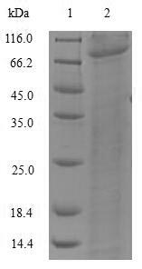 Recombinant Synechococcus sp. Deoxyribodipyrimidine photo-lyase(phr)