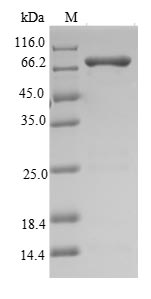 Recombinant Synechocystis sp.Ribonuclease J(rnj)