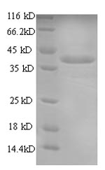 Recombinant Tetronarce californica Acetylcholine receptor subunit alpha(CHRNA1),partial