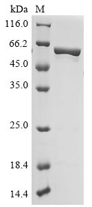 Recombinant Thermus aquaticus DNA polymerase I, thermostable(polA)(M747K),partial