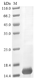 Recombinant Tityus zulianus Beta-toxin Tz1