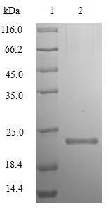 Recombinant Toxoplasma gondii Dense granule protein 1(GRA1)