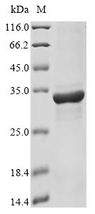 Recombinant Toxoplasma gondii Dense granule protein 2(GRA2)