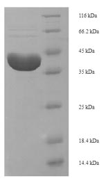Recombinant Trichosanthes kirilowii Ribosome-inactivating protein alpha-trichosanthin