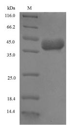 Recombinant Triticum aestivum Omega-5 gliadin,partial