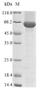 Recombinant Turnip mosaic virus Polyprotein,partial