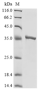 Recombinant Vaccinia virus DNA topoisomerase 1B(TOP1)