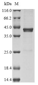Recombinant Vaccinia virus Protein A56(HA),partial
