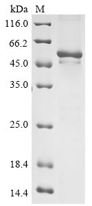 Recombinant Venezuelan equine encephalitis virus Polyprotein P1234,partial