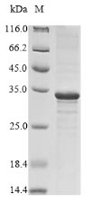 Recombinant Vesicular stomatitis Indiana virus Matrix protein(M)