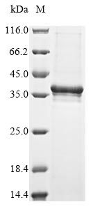 Recombinant Vesicular stomatitis Indiana virus Matrix protein(M)