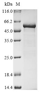 Recombinant Vesicular stomatitis Indiana virus Nucleoprotein(N)