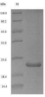 Recombinant Woodchuck hepatitis B virus Protein X(X)