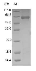 Recombinant Wuchereria bancrofti Putative serine protease inhibitor