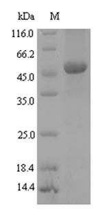 Recombinant Xanthomonas campestris pv. campestris NAD-dependent protein deacetylase(cobB)