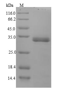 Recombinant Yersinia enterocolitica Attachment invasion locus protein(ail)