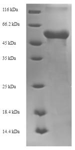 Recombinant Zaire ebolavirus Matrix protein VP40(VP40)