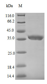 Recombinant Zaire ebolavirus Nucleoprotein(NP) ,partial