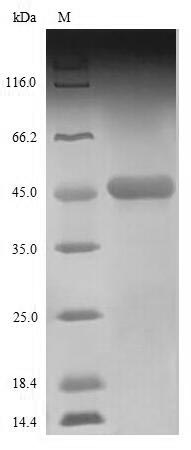Recombinant Zaire ebolavirus Nucleoprotein(NP),partial