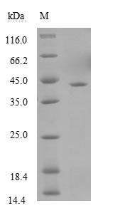 Recombinant Zaire ebolavirus Polymerase cofactor VP35(VP35)