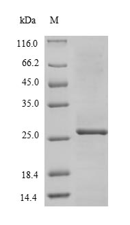 Recombinant Zaire ebolavirus RNA-directed RNA polymerase L(L),partial