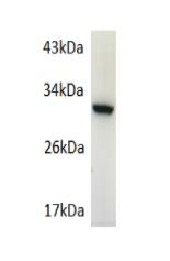 GFP-Tag Rabbit Polyclonal Antibody
