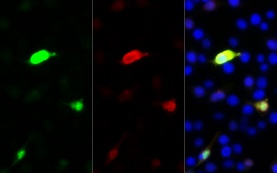 GFP-Tag Rabbit Polyclonal Antibody
