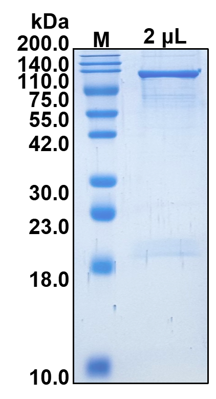 Recombinant Human Signal transducer and activator of transcription 1-alpha/beta (STAT1)