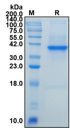 Recombinant Human rspondin-1(RSPO1) protein(Active)